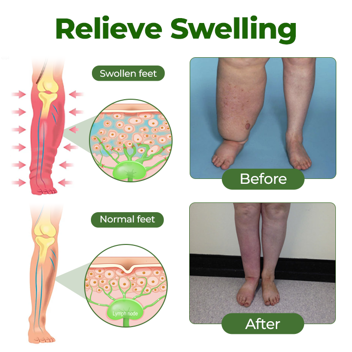 Timlk® Professional Leg Circulation Cream