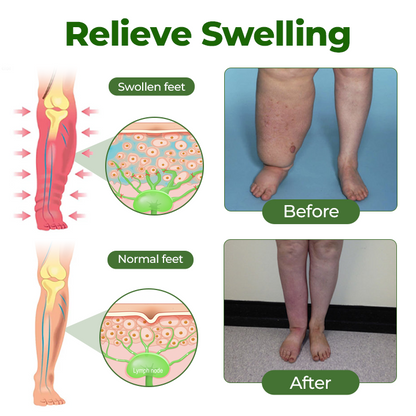 Timlk® Professional Leg Circulation Cream