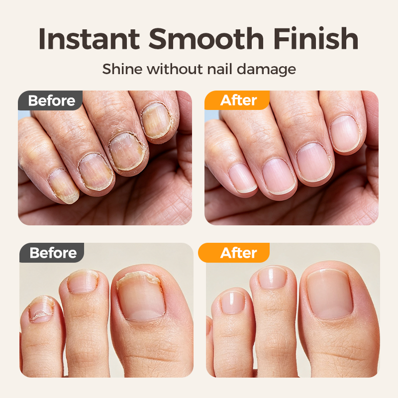 🔥Last Day 50% OFF -✂️ 2-in-1 Smart Electric Nail Clipper & Polisher – Anti-Pinch Safety & LED Light 💅