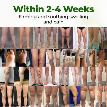 Timlk® Professional Leg Circulation Cream