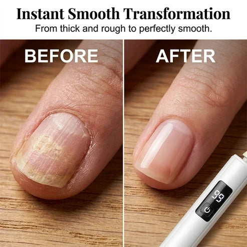 ⏰️Flash Sale 50% OFF💥Professional Ultra-Safe LED Electric Nail Grinder